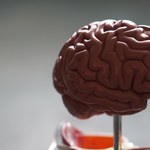 Opracowano narzędzie, które może wykryć guza mózgu. Wykrywa jedno białko