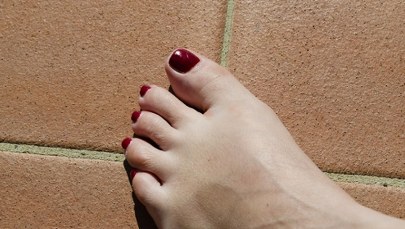 Opuchnięte stopy i nogi w czasie upałów? Są na to sposoby 