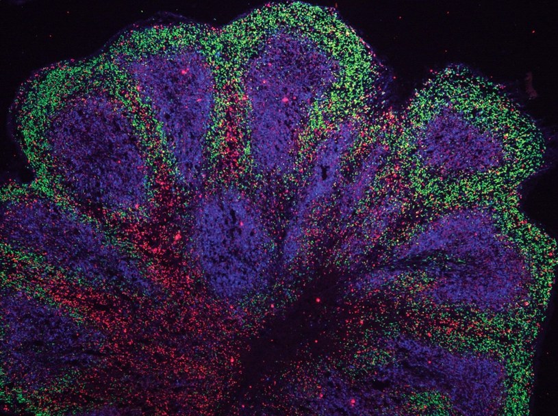 Organoid mózgowy /materiały prasowe