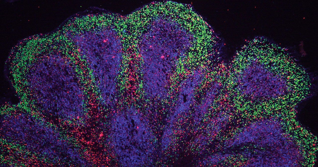 Organoid mózgowy /materiały prasowe