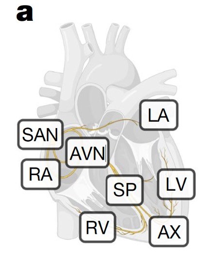 Osiem badanych obszarów serca, w tym węzeł zatokowo-przedsionkowy (SAN) i węzeł przedsionkowo-komorowy (AVN) /Kanemaru et al., Nature, 2023 /materiały prasowe