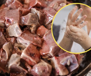 Osiem typów produktów zakazanych w dnie moczanowej. Nasilają objawy 
