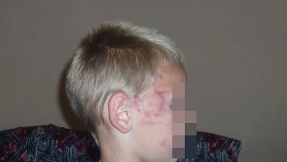 Ośmiolatek pobity na koloniach? Kuratorium kontroluje ośrodek