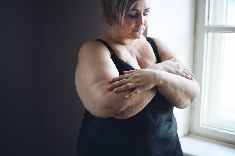 Osoby chore na otyłość są dyskryminowane przez niektórych lekarzy /123RF/PICSEL