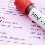 Osoby zakażone wirusem HIV bardziej podatne na zawał serca