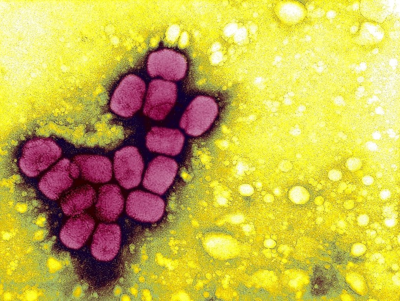 Ospa prawdziwej została eradykowana, ale próbki wirusa wciąż są przechowywane w laboratoriach w USA i Rosji /Getty Images
