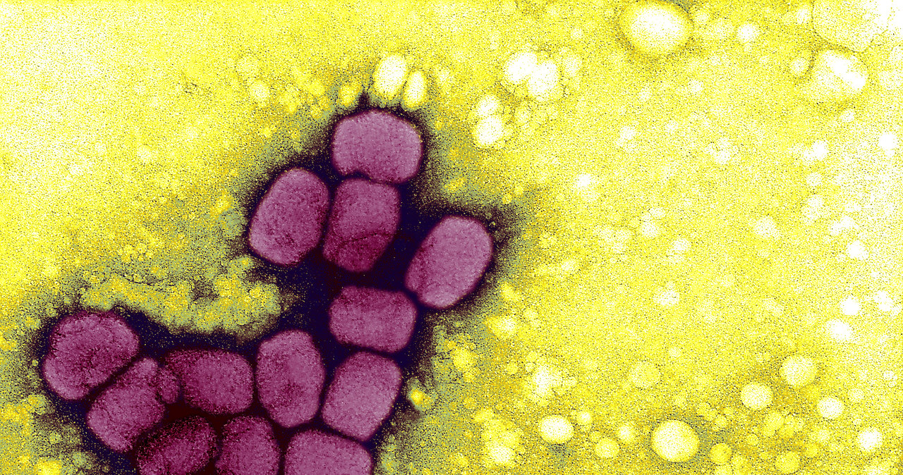 Ospa prawdziwej została eradykowana, ale próbki wirusa wciąż są przechowywane w laboratoriach w USA i Rosji /Getty Images