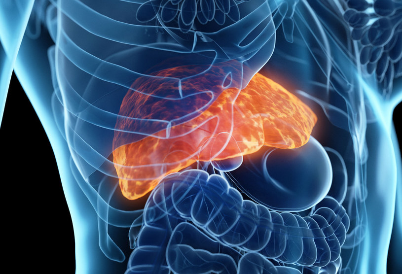 Otłuszczenie wątroby to skutek zbyt dużej ilości tłuszczu w diecie /123RF/PICSEL