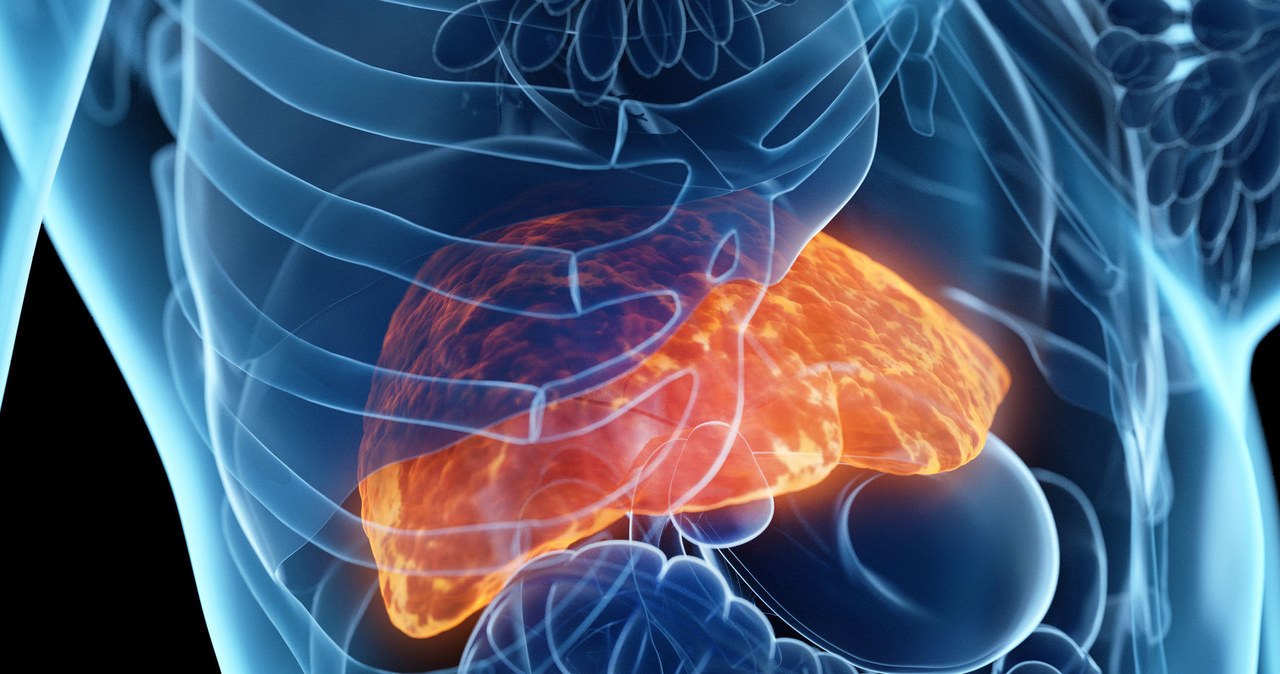 Otłuszczenie wątroby to skutek zbyt dużej ilości tłuszczu w diecie /123RF/PICSEL
