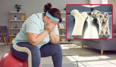 Ozempic nie rozpuszcza kości ani mięśni. Z małego badania powstał wielki mit