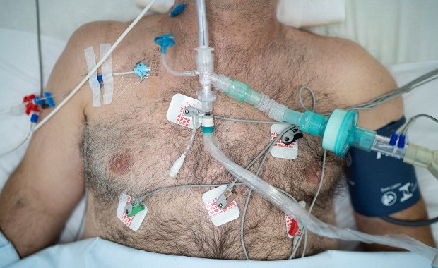 Pacjent po Covid-19 wciąż choruje. Pionierska publikacja naukowców ze Śląska