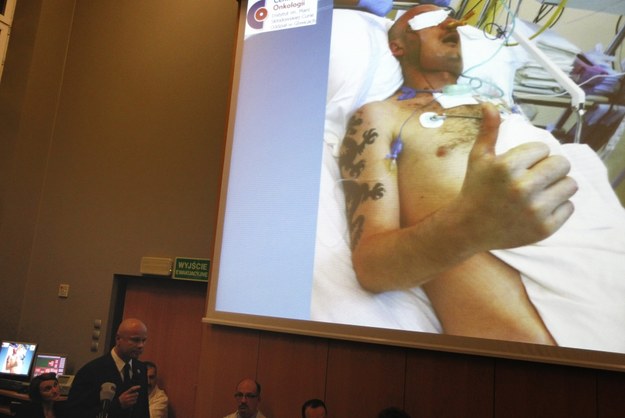 Pacjent stracił w wypadku znaczną część twarzy /Andrzej Grygiel /PAP