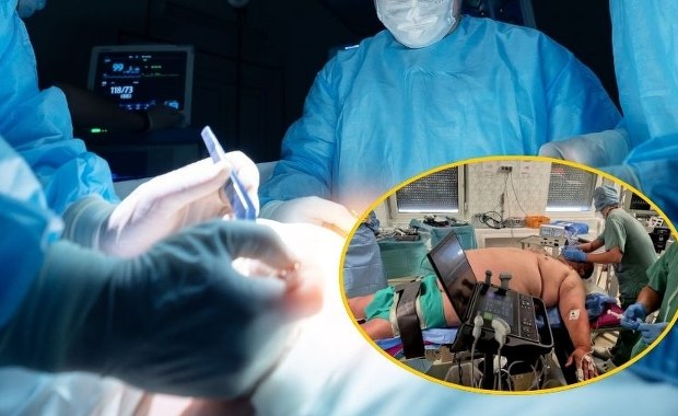 ​Pacjent ważył ćwierć tony, wszystkie metody walki z otyłością zawiodły