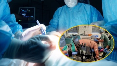 ​Pacjent ważył ćwierć tony, wszystkie metody walki z otyłością zawiodły