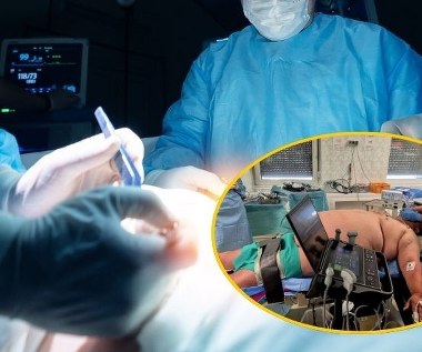 ​Pacjent ważył ćwierć tony, wszystkie metody walki z otyłością zawiodły