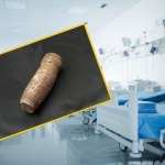 Pacjent z pociskiem artyleryjskim w odbycie. W akcji lekarze i saperzy