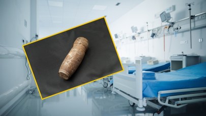 Pacjent z pociskiem artyleryjskim w odbycie. W akcji lekarze i saperzy