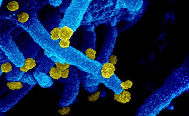 Pacjentka miała koronawirusa przez 105 dni. To absolutny rekord!