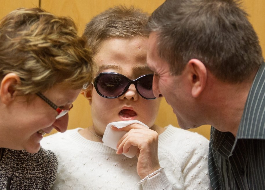 Pacjentka po przeszczepie twarzy /PAP/ Andrzej Grygiel /PAP