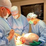 Pacjentka z guzem jajnika o średnicy 46 centymetrów. Bydgoscy specjaliści: Badania ratują życie!