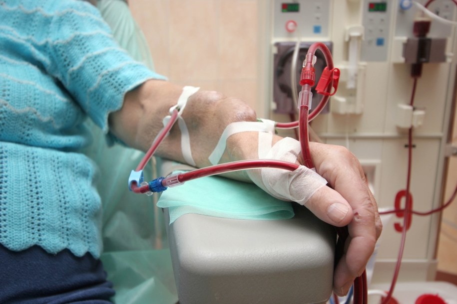 Pacjentka zarażona wirusowym zapaleniem wątroby podłączona do aparatury dializującej w stacji dializ w Ostrowie Wlkp. /Tomasz Wojtasik /PAP