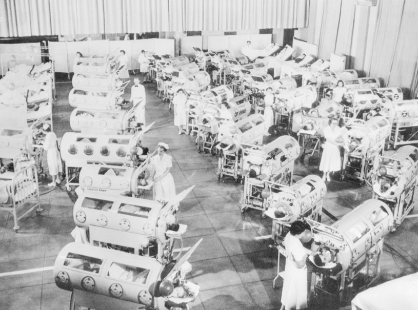 Pacjentów z polio umieszczano w tzw. żelaznych płucach - wczesnej wersji respiratora /Everett /Agencja FORUM