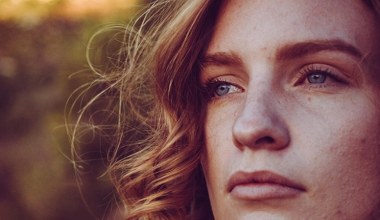 Pajączki na twarzy już się nie pojawiają. Specjalna cera wymaga specjalnej pielęgnacji