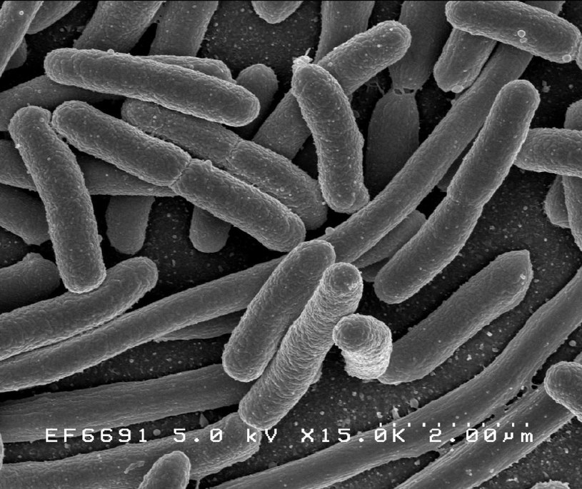 Pałeczka okrężnicy, czyli słynna bakteria E. coli /National Institute of Allergy and Infectious Diseases (NIAID) /domena publiczna