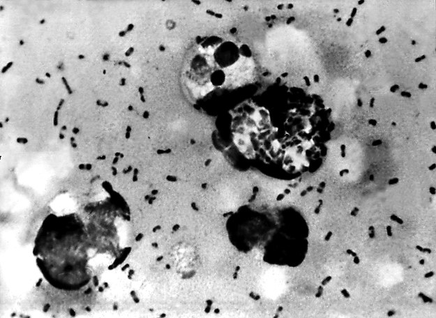 Pałeczki dżumy pod mikroskopem /CDC /PAP/EPA