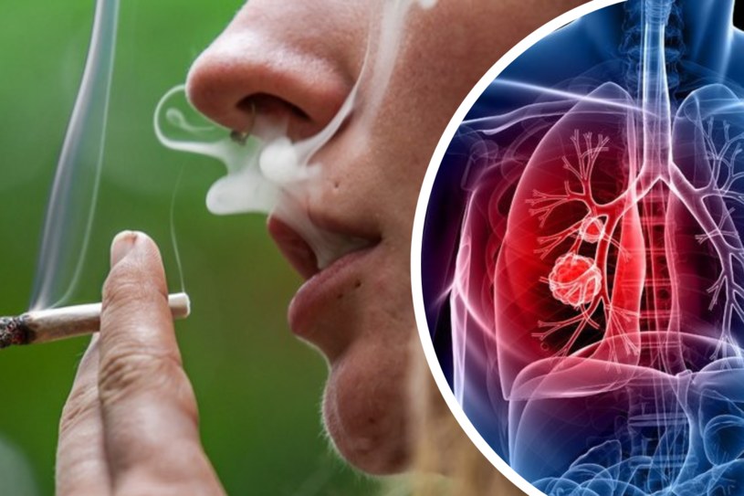 Palenie papierosów zwiększa ryzyko zachorowania na raka płuc kilkunastokrotnie. Bierni palacze również są w grupie ryzyka /123RF/PICSEL