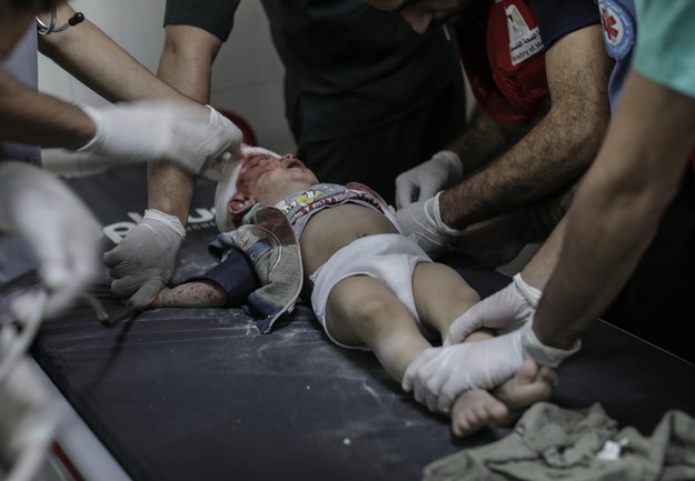 Palestyńskie dziecko ranne w izraelskim ostrzale /HAITHAM IMAD /PAP/EPA