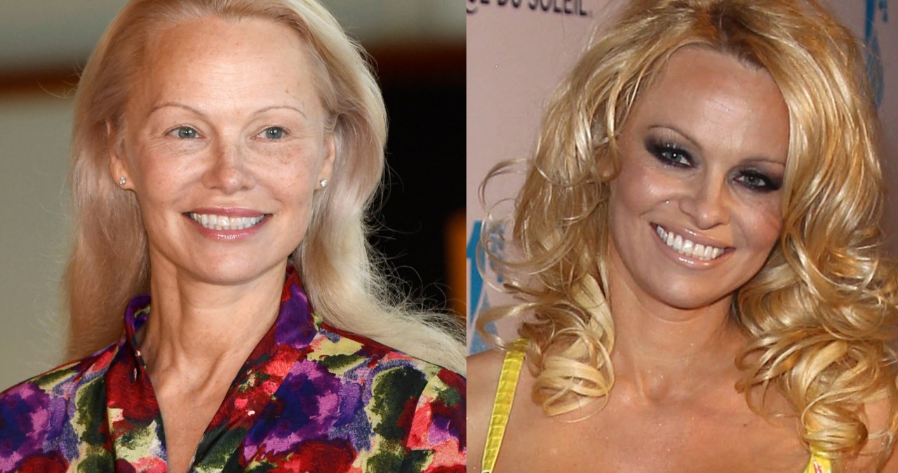 Pamela Anderson jest dzisiaj nie do poznania. To dlatego zmieniła wizerunek /Clemens Niehaus / ddp images / Forum / AKM Images / Backgrid USA / Forum /Agencja FORUM