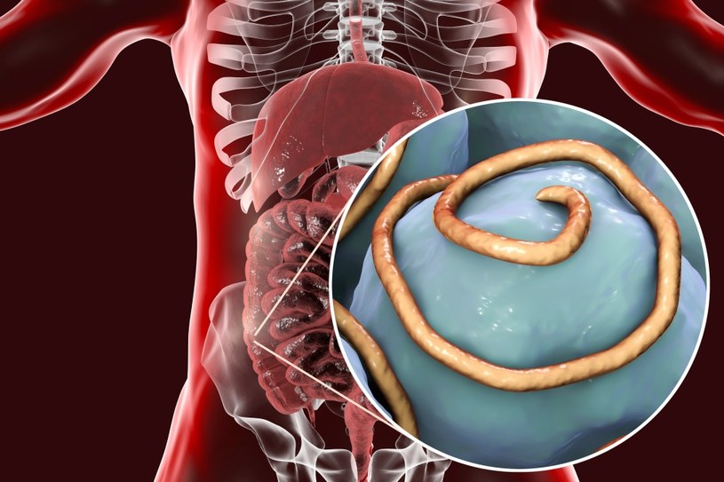 Pasożyty ludzkie mogą rozwijać się naszym ciele, nie dają na początku żadnych objawów /123RF/PICSEL