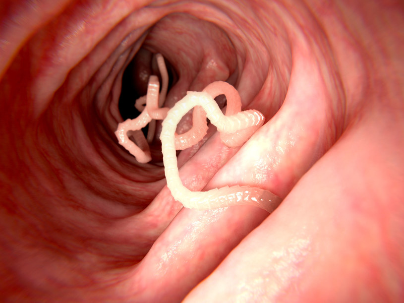 Pasożyty przenikają do organizmu człowieka i zagnieżdżają się w tkankach różnych narządów wewnętrznych /123RF/PICSEL