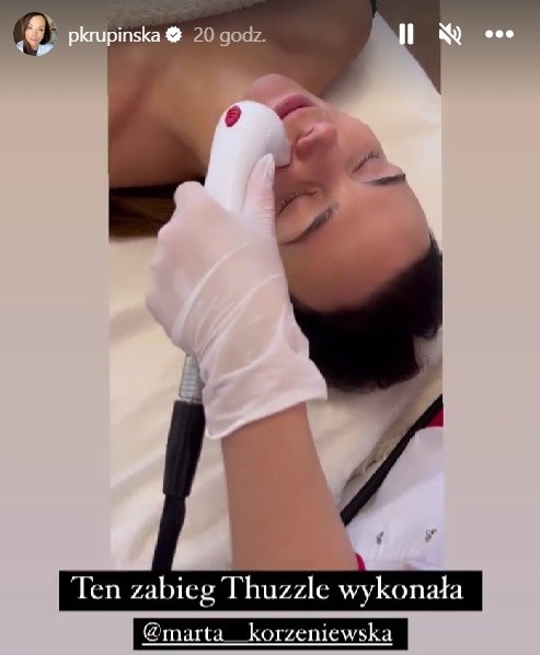 Paulina Krupińska poddała się zabiegom kosmetycznym, upiększającym twarz. /Instagram @pkrupinska /Instagram
