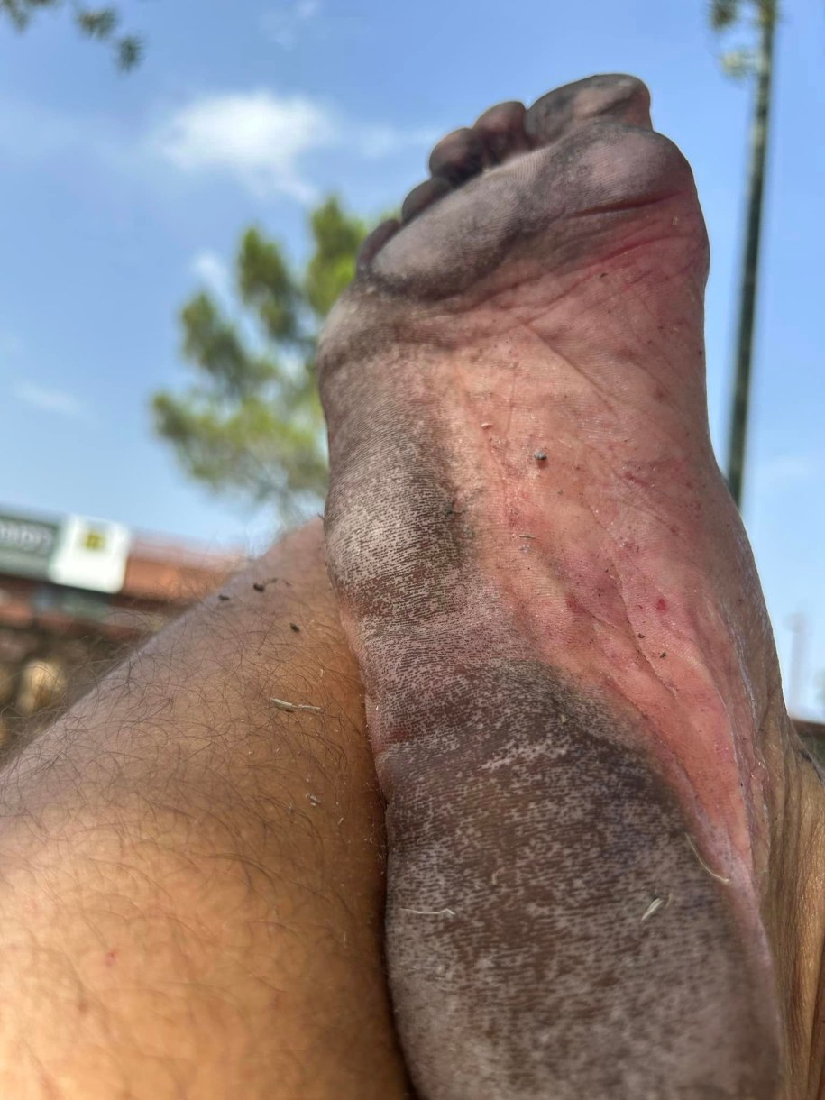 Paweł pokazał, jak wyglądają jego stopy po marszu /Paweł Durakiewicz /Archiwum prywatne