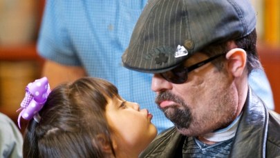 Pełny przeszczep twarzy zakończony sukcesem