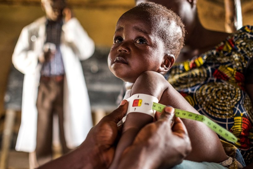 Personel medyczny mierzy dziecko w ramach programu dla niedożywionych dzieci sponsorowanego przez World Food Program. /EDUARDO SOTERAS /AFP