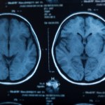 Pięć faz rozwoju mózgu człowieka. Kiedy następują przełomowe zmiany?