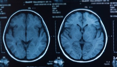 Pięć faz rozwoju mózgu człowieka. Kiedy następują przełomowe zmiany?