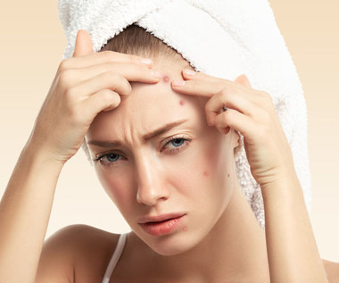 Pięć problemów ze skórą, które są efektem zaburzeń hormonalnych
