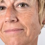 Piegi można skutecznie zredukować jesienią. Sprawdź, jak to zrobić w kilka tygodni