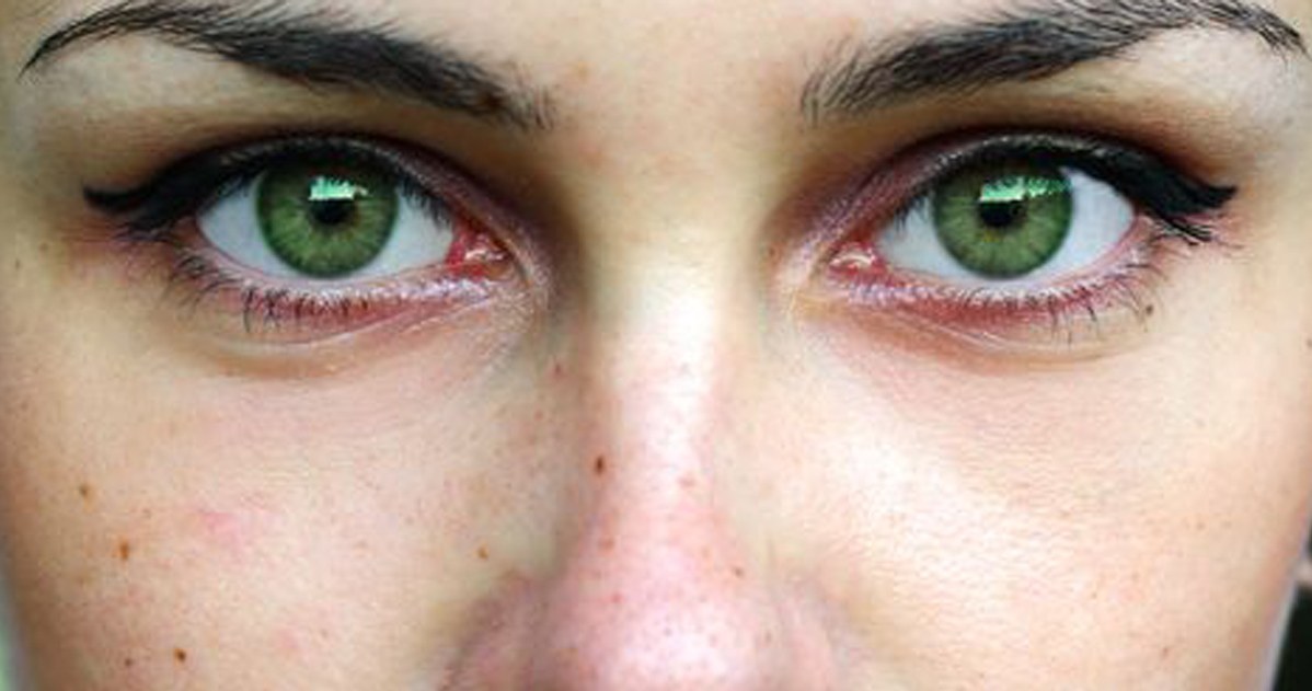 Pieprzyki na ciele to nie przypadek. Niektórzy wierzą, że te na czubku nosa mają najbardziej ambitne i zdeterminowane osoby /123RF/PICSEL