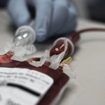 Pierwsi pacjenci po transfuzji komórek krwi wyhodowanych w laboratorium