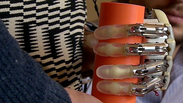 Pierwsza bioniczna proteza ze zmysłem dotyku do użycia poza laboratorium /materiały prasowe