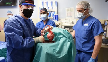 ​Pierwsza ksenotransplantacja serca u człowieka. Przełom, na który czekaliśmy