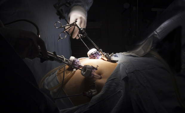 Pierwsza taka operacja dziecka w Polsce. Wykonali ją śląscy lekarze