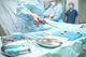 Pierwsza w Polsce operacja żołądka przez usta