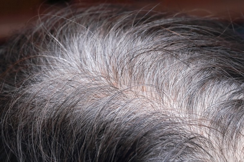 Pierwsze siwe włosy? Wszystko zależy od kwestii genetycznych /123RF/PICSEL