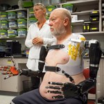 Pierwszy pacjent już steruje dwoma bionicznymi ramionami